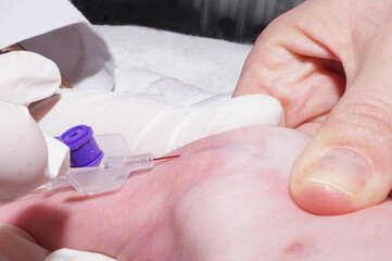 Pediatric intensive care. Perinatal Medicine. Infant resuscitation. A small child is given an injection.