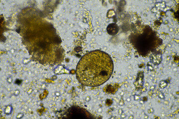 arcella testate amoebae under the microscope from a soil sample on a farm. a living soil