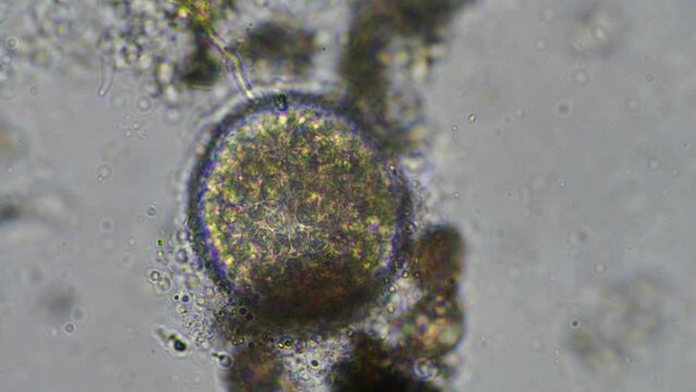 arcella testate amoebae under the microscope from a soil sample on a farm. a living soil