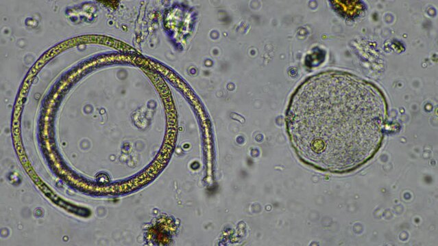 soil microorganisms under the microscope from a soil sample off a cow farm