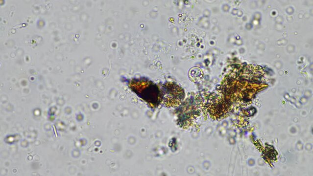living soil life in a soil sample under the microscope in a lab