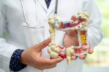 Intestine, appendix and digestive system, doctor holding anatomy model for study diagnosis and...