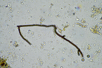 fungal hyphae on a soil sample on a farm. fungi storing carbon in the soil