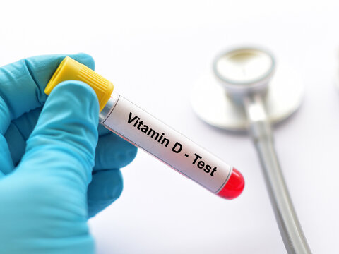 Blood sample tube for vitamin D test