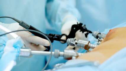 Close up of hands of surgeons team during operation uterus removal with surgical laparoscopy...
