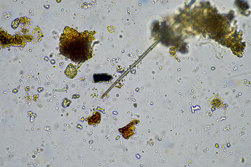 fungal hyphae on a soil sample on a farm. fungi storing carbon in the soil