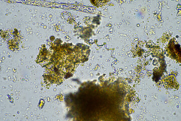 plant cellulose in a soil sample under the microscope