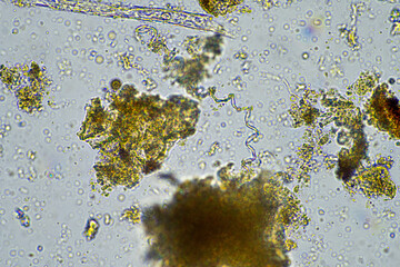 plant cellulose in a soil sample under the microscope