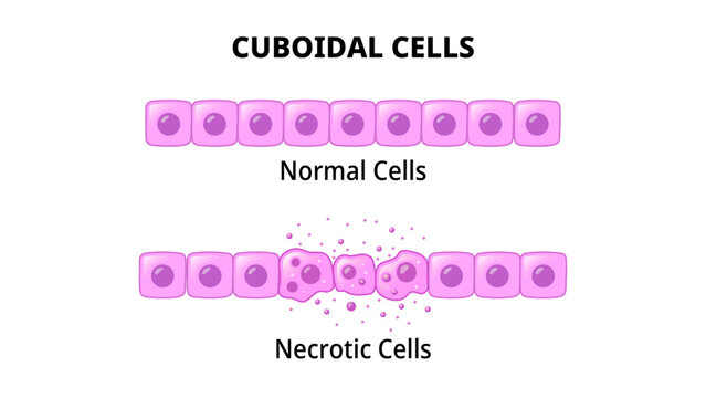 Cuboidal Cells - Normal Cell - Necrotic Cell - Medical Vector Illustration