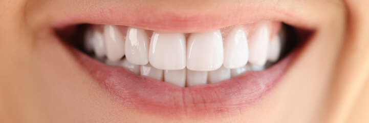 Close-up of healthy smooth white teeth smile.