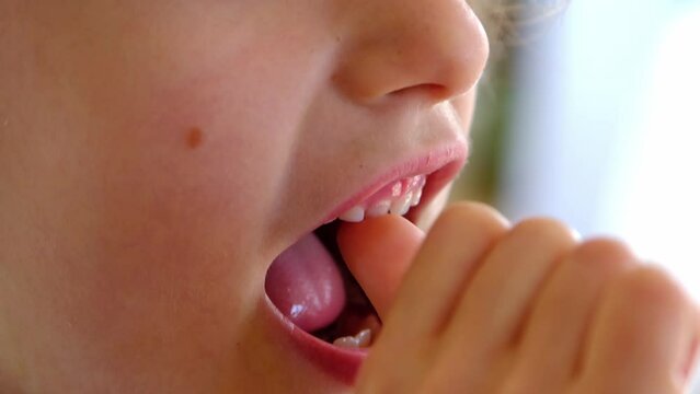 The child shakes the front baby tooth and smiles a toothless smile close-up. Changing teeth to molars in childhood