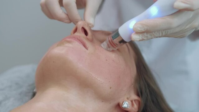 Close up footage of young woman having vacuum cleaning and polishing face skin at cosmetician.