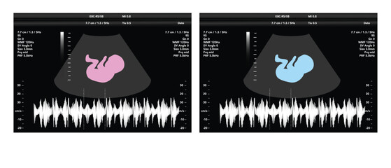 pregnancy ultrasound film genecology sonogram, medical ultra scan diagnostic control vector illustration graphic