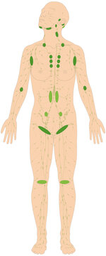 Infografik Lehrmaterial: Lymphknotengruppen des Menschen - Lymphsystem - Lymphgef&auml;&szlig;e Lymphknoten