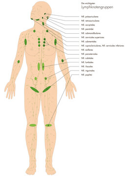 Infografik Lehrmaterial: Lymphknotengruppen des Menschen - Lymphsystem - Lymphgef&auml;&szlig;e Lymphknoten - Beschriftung: lateinisch