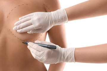 Breast augmentation. Doctor with marker preparing woman for plastic surgery operation against white...
