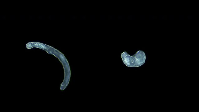 Parasitic worm cercaria Lecithaster salmonis under a microscope, class Trematoda. White Sea