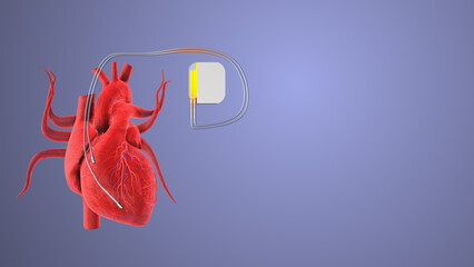 Cardiac pacemaker heartbeat wave insert