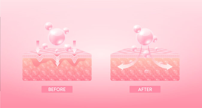 Collagen serum oil drop absorbed into the skin cell. Before and after process of getting skin younger with help of moisturizer hyaluronic acid. skin solutions for cosmetic advertising. 3D Vector EPS10