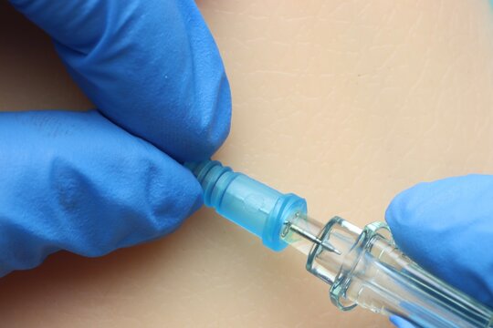 Intravenous catheter beeing inserted in a simulated patient skin. 
