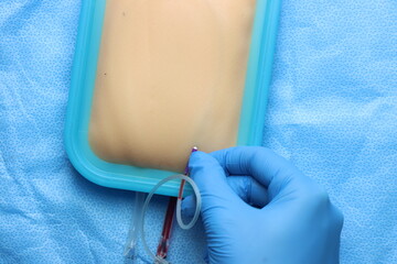 Student training in a simulated patient skin the butterfly catheter insertion. Catheter well...
