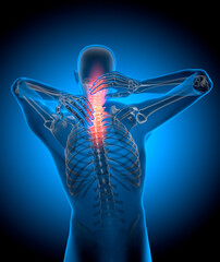 X-ray 3D Illustration of a man with strong pain in neck - 3D Illustration