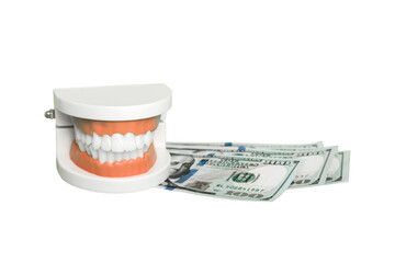 Closeup model of a human jaw with white teeth and dollar bill. Dentistry conceptual photo....