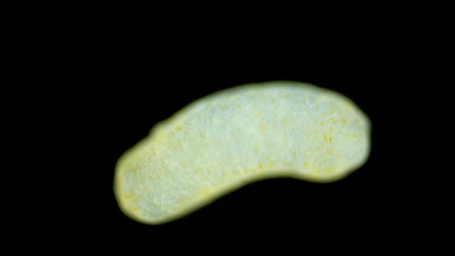 Sporocyst stage of parasitic worm Podocotyle sp. under a microscope, family Opecoelidae. Cercaria larvae develop inside it. Mollusca host. White Sea