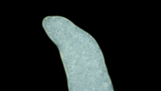 Sporocyst stage of parasitic worm Podocotyle sp. under a microscope, family Opecoelidae. Cercaria larvae develop inside it. Mollusca host. White Sea
