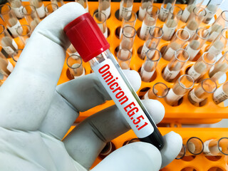 Blood sample for Covid-19 Omicron EG.5.1 (Eris) test. A new Covid-19 variant which has descended...