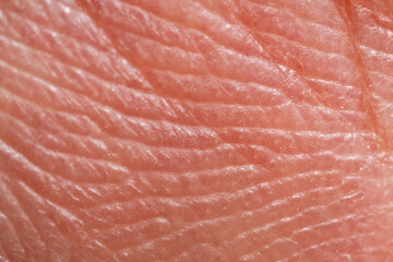 Skin diseases concept. macrophotograph of human skin under microscope, manified 5x. Medicine and...