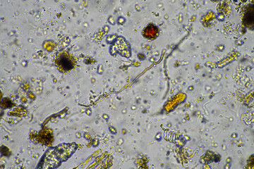 fungal hyphae and soil fungi in a soil sample, showing the living soil