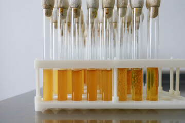 Test tubes in research lab with nutritial solution.