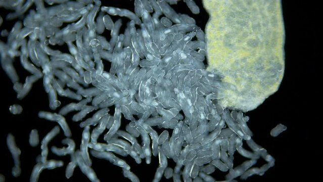 Sporocyst stage of parasitic worm Podocotyle sp. under a microscope, family Opecoelidae. Cercaria larvae emerge through maternity pore. Mollusca host. White Sea