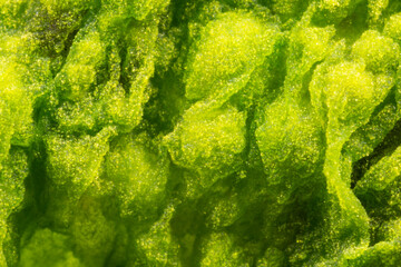 Cyanobacteria, Cyanobacteriota or Cyanophyta a layer on the water surface, water pollution,  micro photography under microscope - magnified 5x