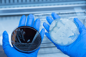 Scientist hand wearing blue gloves hold agar plate for diagnosis bacterial or microorganism in the...