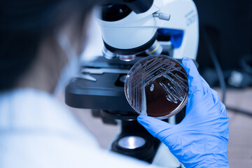 Scientist holding agar plate for diagnosis bacterial or  microorganism, blurry microscopy background at laboratory. Selective petri dish with colonies of bacteria under the lens of a microscope.