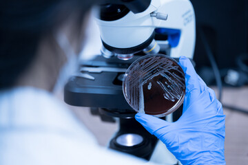 Scientist holding agar plate for diagnosis bacterial or  microorganism, blurry microscopy...