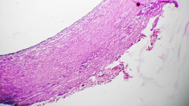 Artery of human being in longitudinal section filmed under microscope 40x on bright field. Macro footage of blood vessel made in biological lab to study its structure. Scientific experiment in anatomy