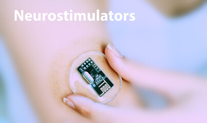 Neurostimulators Implantable Electronic Medical Devices Concept