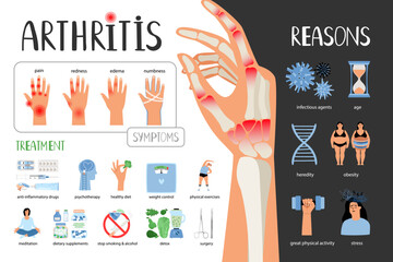 Rheumatoid arthritis vector medical poster. Symptoms treatment reasons of the disease. Medical infographic set with icons and other elements - obrazy, fototapety, plakaty