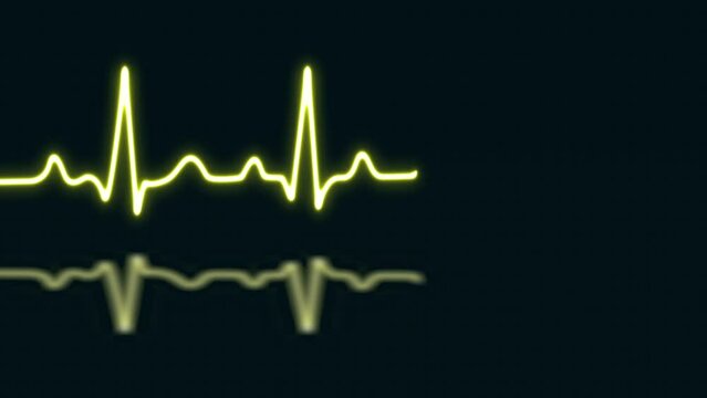 Yellow neon heartbeat with love shaped isolated on blue grid background. Medical concept and ecg pulse line graph