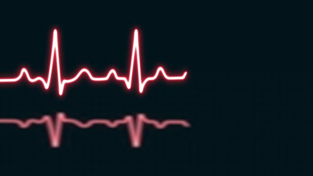Red heartbeat with love shaped isolated on grid background. Medical concept and ecg pulse line graph