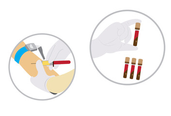 vector illustration of icon of taking blood donation to patient