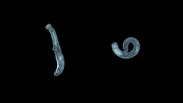 Parasitic worm cercaria Lecithaster salmonis under a microscope, class Trematoda. White Sea