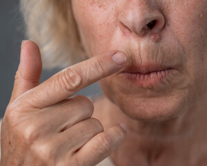 Unhappy elderly woman pointing at wrinkles around her lips. 