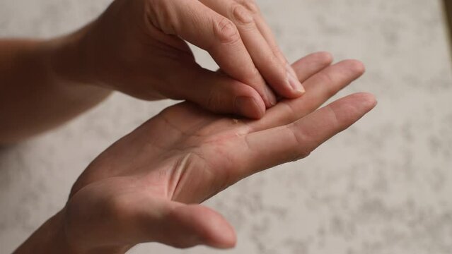 Close-up cropped shot of unrecognizable young man scratching and tearing off callus on palm of hand. Nervous male stresses out and rips some of skin off arm. Concept of bad habits, slow motion.