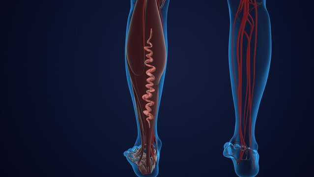 Concept of vascular disease, venous insufficiency, and varicose veins on the leg