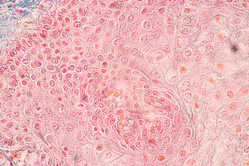 Showing Light micrograph of the Sublingual gland, Oesophagus human and Tongue human under the...