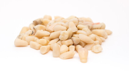 Human teeth on a white background, dentures teeth pulled out. Dentistry, orthodontist. Dentures. tooth loss